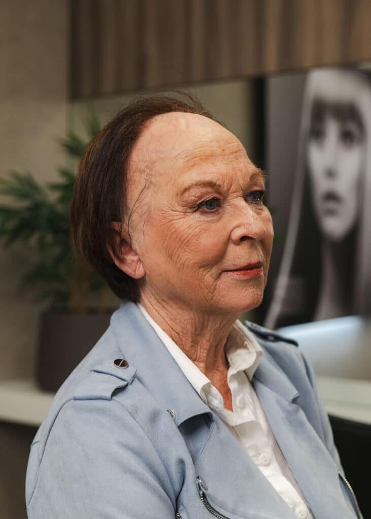 Frontale fibroserende alopecia